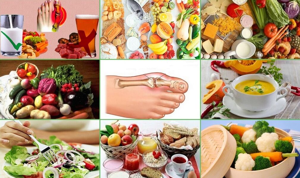 ēdieni un produkti podagras ārstēšanai